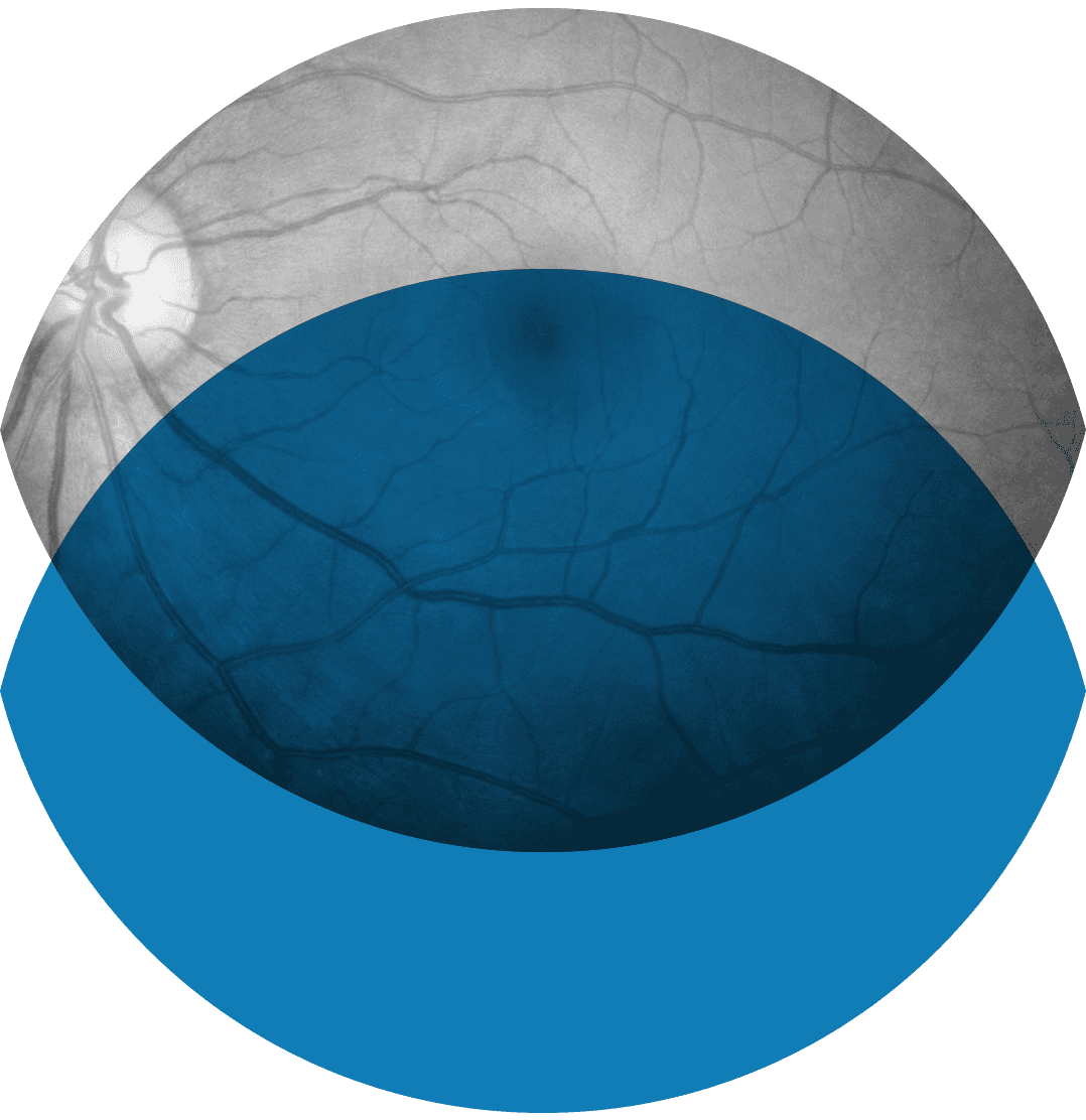 Oculux - Medische retina