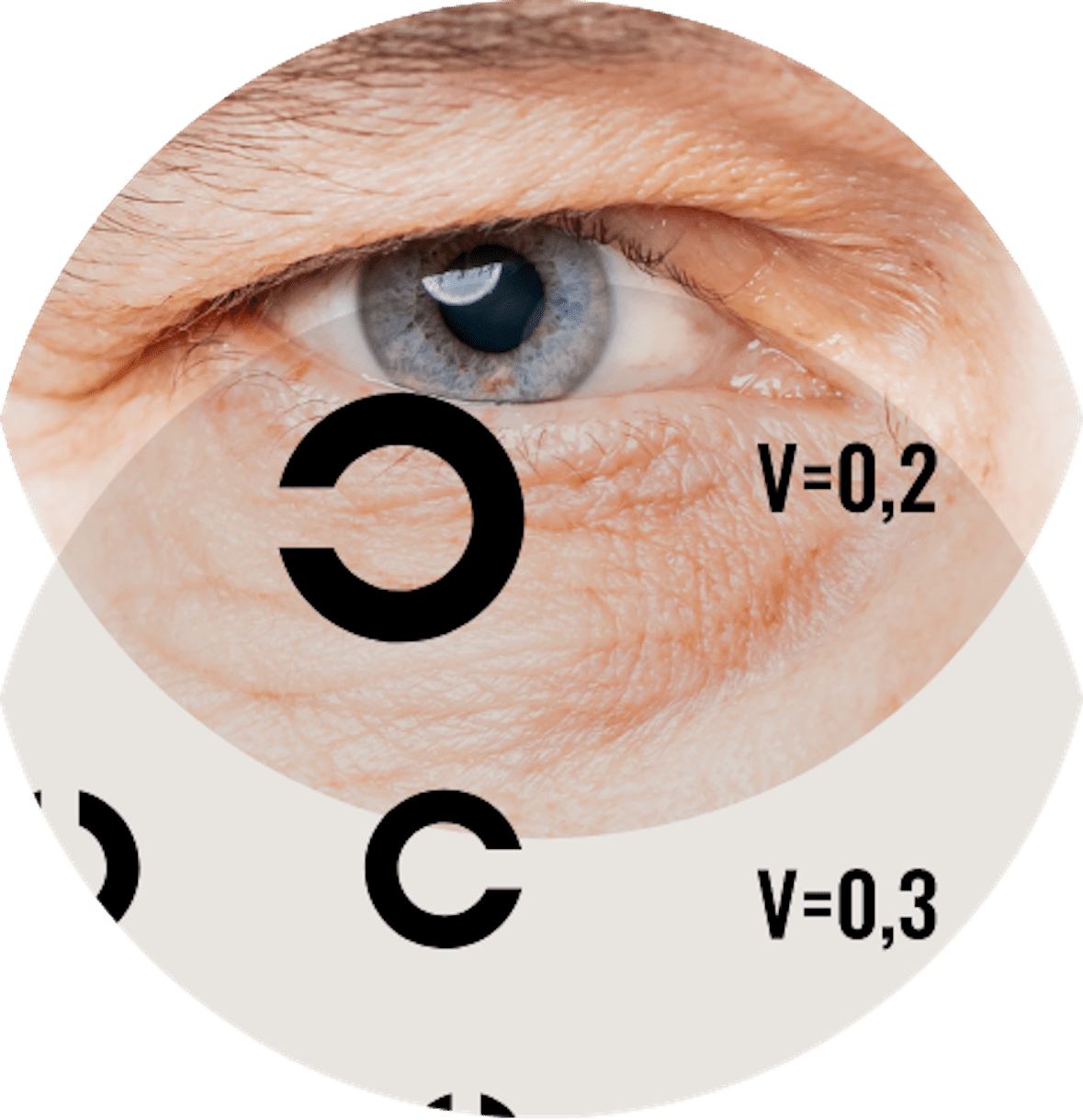 Oogcentrum Oculux ooglidcorrectie